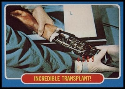 4 Incredible Transplant